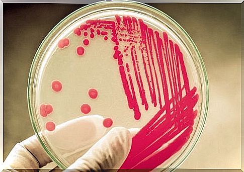 Petri dish, growth of microorganisms