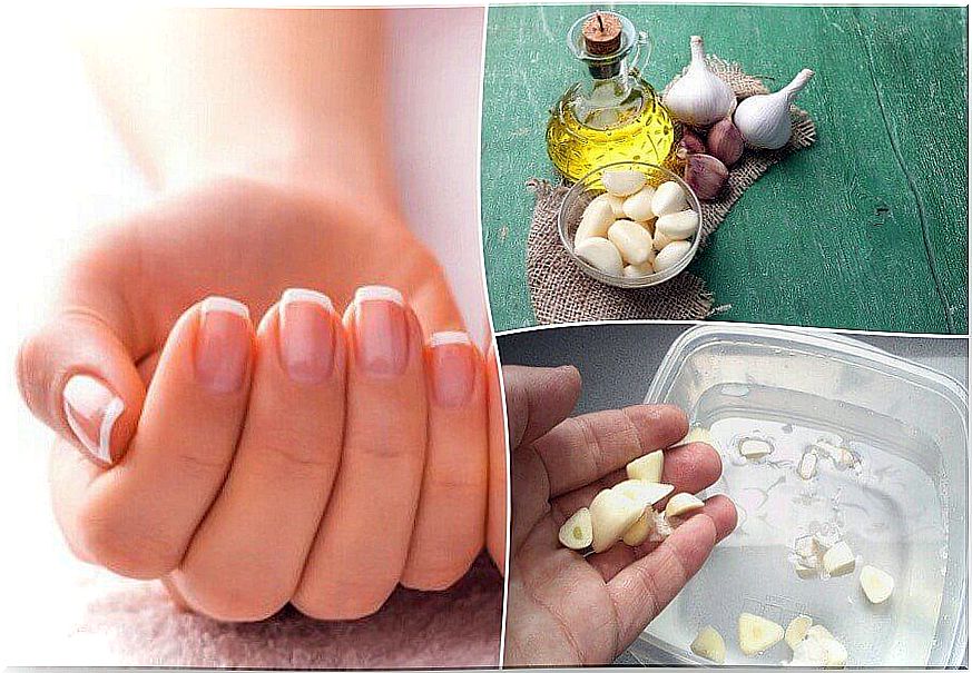 How to do 5 home treatments to accelerate nail growth