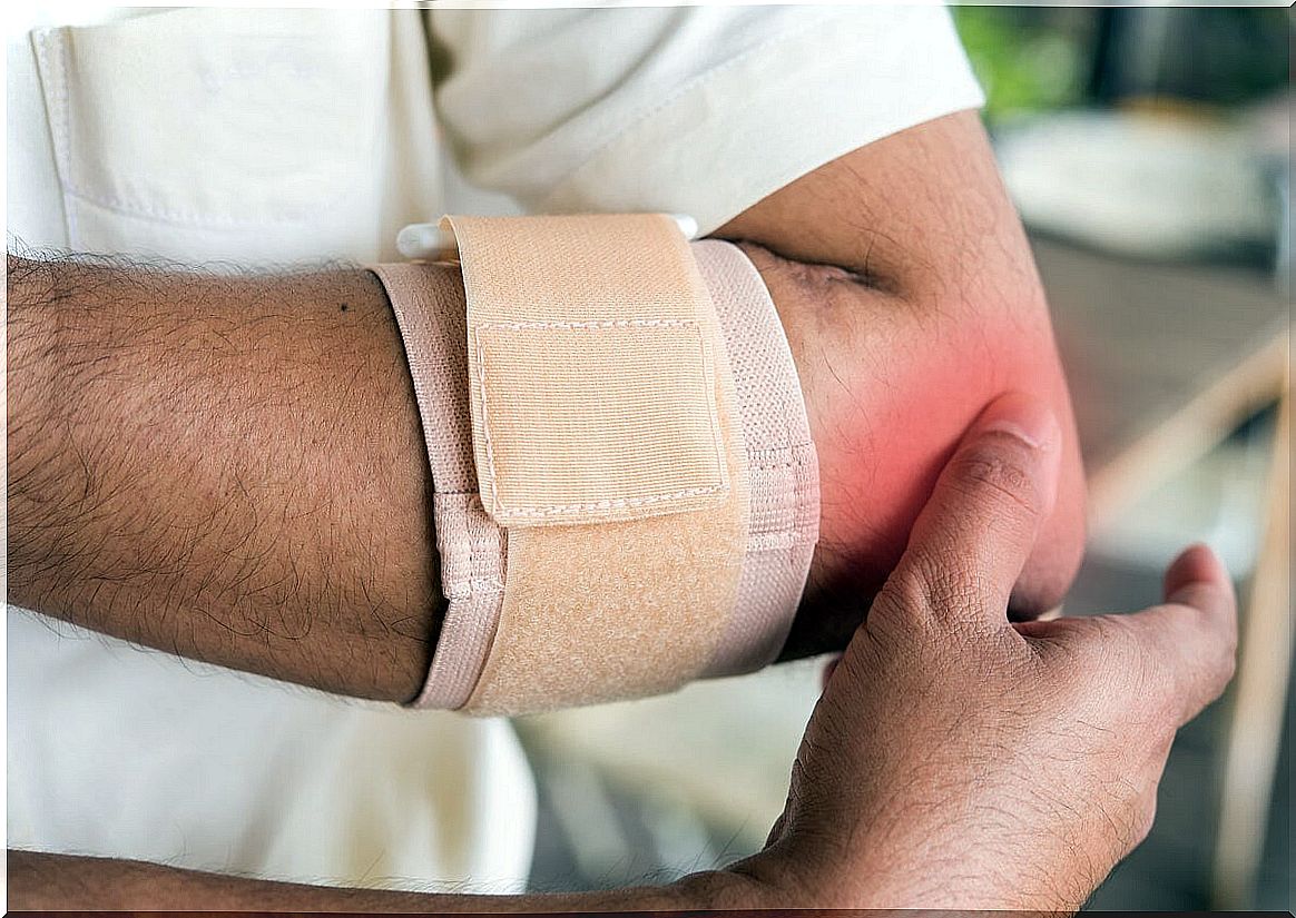 Elbow immobilization to treat tenosynovitis.