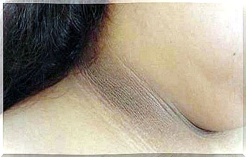 Reduces darkening of the neck skin
