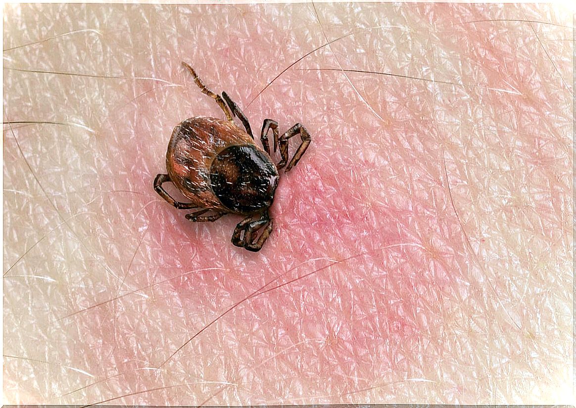Tick ​​bites the skin and is sensitive to vetiver oil.